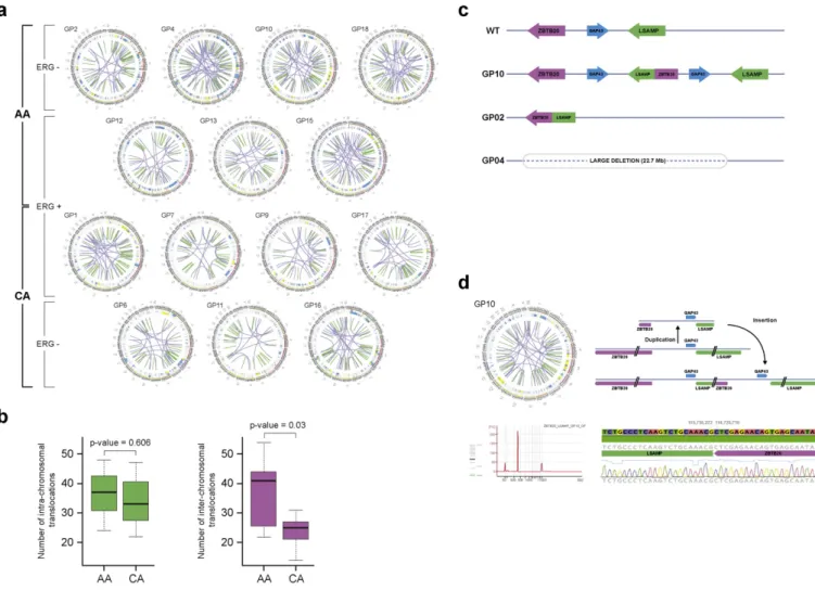 Fig. 2. Signiﬁcantly higher number of inter-chromosomal rearrangements and exclusive association of chromosome LSAMP deletion/rearrangement in prostate cancer of AA men.