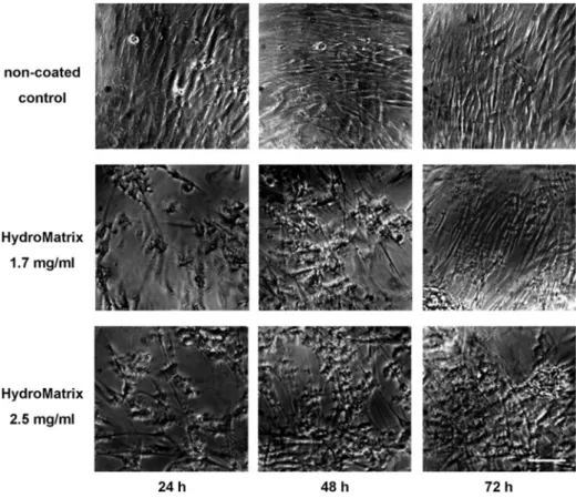 Fig. 2. Morphology of PDLSCs on non-coated and HydroMatrix (HydM)-coated surfaces studied by phase contrast microscopy