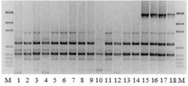Figure X. Class-1 integron patterns of the A. baumanni strains isolated in this study  Lanes 2-18: integron patterns of isolates obtained in the present study; Lanes 1, 19 (M): 