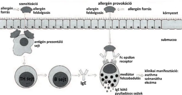 3. ábra: A szenzibilizáció, allergén-specifikus IgE termelődés kialakulásának folyamata  az első allergén ingert követően, majd ismételt antigén expozíció során felamplifikálódó  folyamat révén létrejövő degranuláció után kialakul a gyulladásos reakció