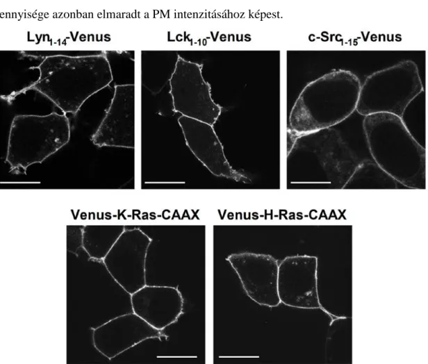 8. ábra –  A PM-hoz irányított Venus konstrukciók sejten belüli elhelyezkedésének vizsgálata  Az irányító- irányító-szekvenciákkal módosított Venus fehérjék intracelluláris lokalizációja, a fehérjéket tranziensen kifejező HEK 293T  sejtekben, konfokális mi