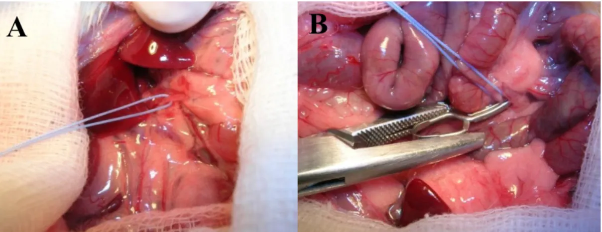 13. ábra (A) Az arteria mesenterica superior kiperarálása  és occlusiója (B) atraumatikus microvascularis klip  alkalmazásával.