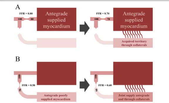 Figure 5 – Role of collaterals. In case of a coronary artery, which provides  collaterals  to  an  occluded  artery,  the  supplied  myocardial  mass  and  consequently the blood flow are much larger then normally