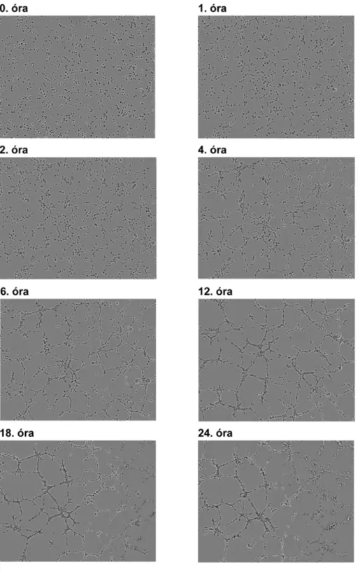 25. ábra Az in vitro angiogenezis különböz ő  fázisai. A fotókat IncuCyte ZOOM ®  készülékkel készítettük