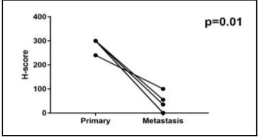 Figure  5.  Comparison  of  AQP1  expression  in  primary  and corresponding brain metastatic tumors