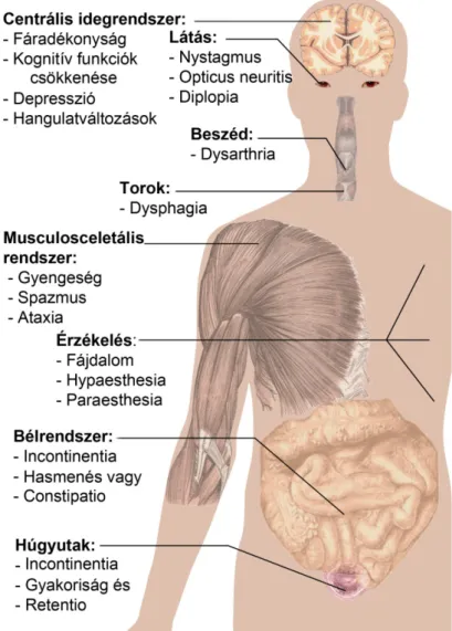 10. ábra. A sclerosis multiplex tünetei szervrendszerenként (átdolgozva az alábbi forrás  alapján: http://en.wikipedia.org/wiki/Sclerosis_multiplex, utolsó hozzáférés: 2012