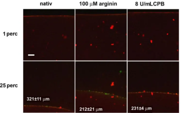 6. ábra: Arginin és CPB hatásai a tPA-YFP fibrin-penetrációjára  a lysis folyamata során 