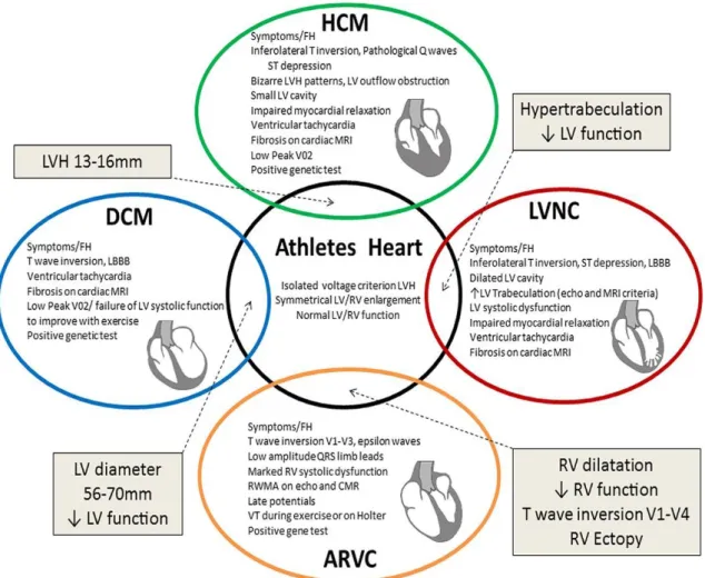 Figure  3:  The  Grey  zone  of  overlap  between  physiological  and  pathological  remodelling causing diagnostic dilemmas (32)