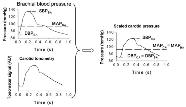 Figure 4. Calibration method for central pulse pressure. 