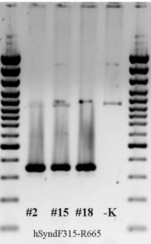 6. ábra. PCR amplifikálással kimutatott humán syndecan-1 transzgén. A #2-es hím,  a #15-es és #18-as számú állatok nőstények