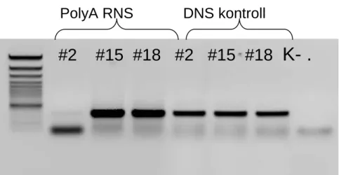 7. ábra. A humán syndecan-1 transzgén és a róla képződő mRNS kimutatása PCR  és RT-PCR technikával 