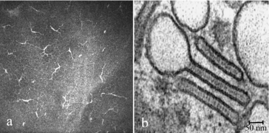 9. ábra A corneális Langerhans-sejtek: a) jellegzetes konfokális kép (saját anyag), b)  a teniszütő alakú intracelluláris Birbeck-granulum (66)