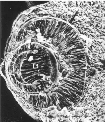 1. ábra. Pásztázó elektronmikroszkópos felvétel egérembrió szemén áthaladó metszetekről