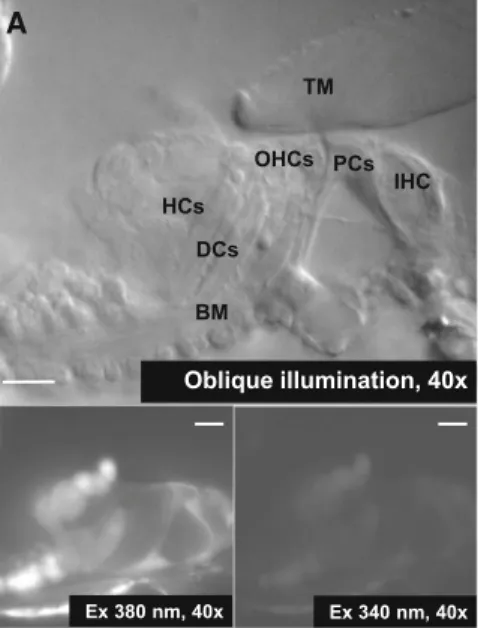 Fig. 1 Calcium imaging of the supporting cells in the hemicochlea preparation of hearing mice