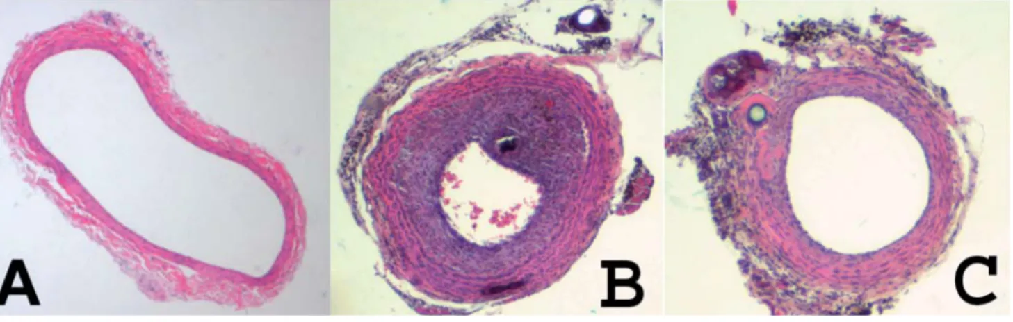 3. ábra Hematoxilin-eozin festett metszetek patkány a. carotis communisból.