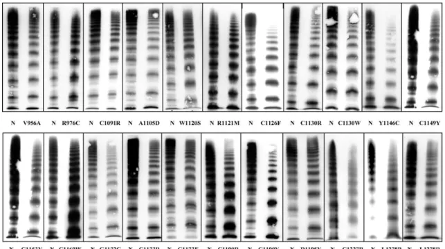 12. ábra: 2A/IIE variáns VWB-k multimer képei. A 'N' a normál plazma, mellette pedig  a betegséget érintő mutáció (104) 
