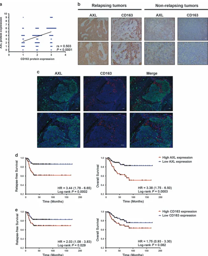 Figure 2. AXL expression correlates with the in ﬁ ltration of CD163-positive cells in tumor stroma and is associated with survival in triple- triple-negative breast cancer