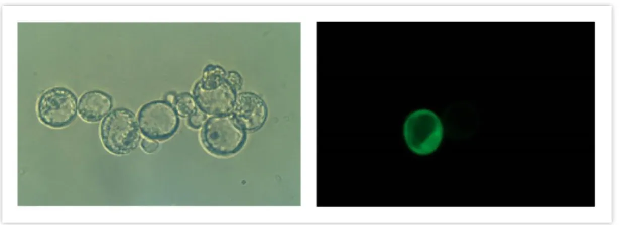 1. ábra. Arabidopsis thaliana protoplasztok. Gyökér sejtszuszpenzióból származó, AtMPK9- AtMPK9-GFP-t túltermelő fénymikroszkópos (balra) és fluoreszcens mikroszkópos képe (jobbra)
