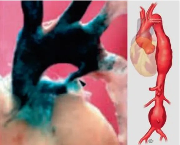 2. ábra A velősánc-eredetű sejtek festődése emlősben a ligamentum arteriosum  szintjéig tart 27