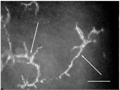 13. ábra. Könnyfilm szemcsék (nyilak) konfokális mikroszkópos képe (SSCM) 
