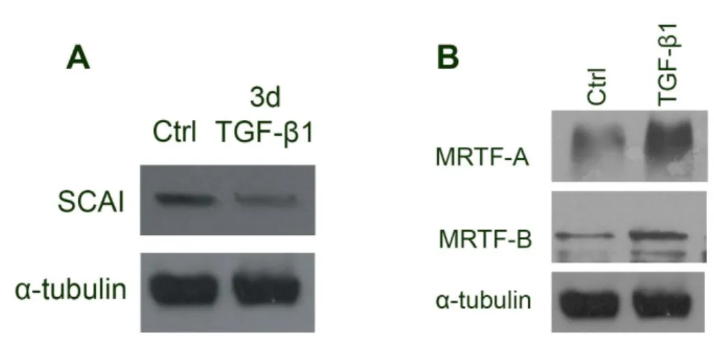 8. ábra: TGF-β1-kezelés hatása a SCAI-, MRTF-expresszióra LLC-PK1 sejtekben.  A: 