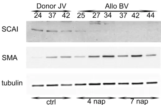10. ábra:  SMA- és SCAI-expresszió rejekciós modellben. Western blot analízis. LBNF1- LBNF1-LEW  patkányok  bal  vese  (BV)  allograftjának  és  a  donor  jobb  veséjének  (JV)  összehasonlítása  4,  illetve  7  nappal  a  transzplantációt  követően