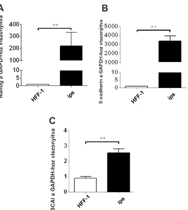 13. ábra: Fibroblastok iPS reprogramálásának hasonlósága a mesenchymalis epithelialis  transitióval, mRNS-expresszió