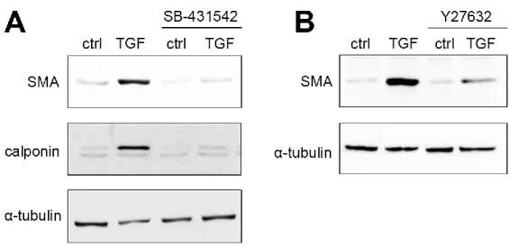 15. ábra: A TGF-β1 kiváltotta SMA-expresszió TGFβ-receptorhoz és ROCK-hoz kötött. 