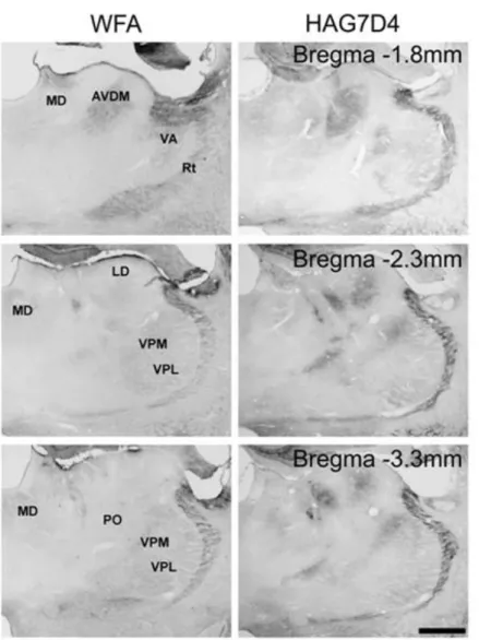 6. ábra: WFA lektinreaktivitás és HAG7D4 immunoreaktivitás patkány talamusz koronális metszetein