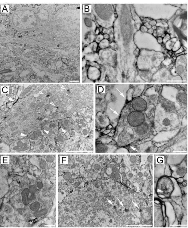 8. ábra: A képeken a HAG7D4 immunoreaktivitás különböző előfordulási helyeit láthatjuk a patkány nucleus  ventralis posteromedialisában