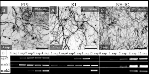 15. Ábra: Idegsejt képzés az NE-4C, P19 és R1 sejtek retinsav által indukált idegi  differenciációja  során