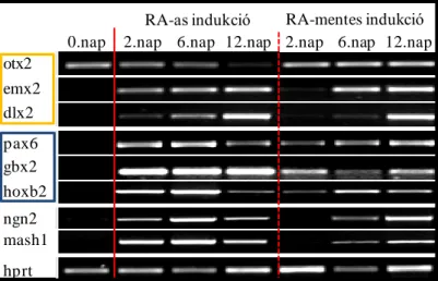 17. Ábra:  A régió  specifikus gének expressziós mintázata a  RA-val  illetve a RA  nélkül  indukált  idegi  differenciáció  során
