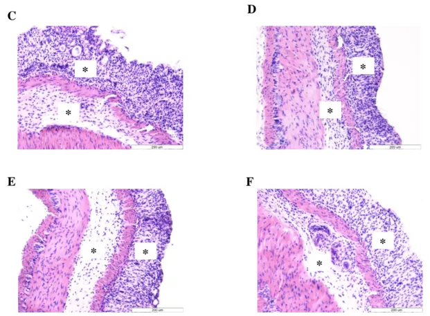 9. ábra. Disztális colon szegmensek hematoxilin-eozinnal festett reprezentatív szövettani  fotói