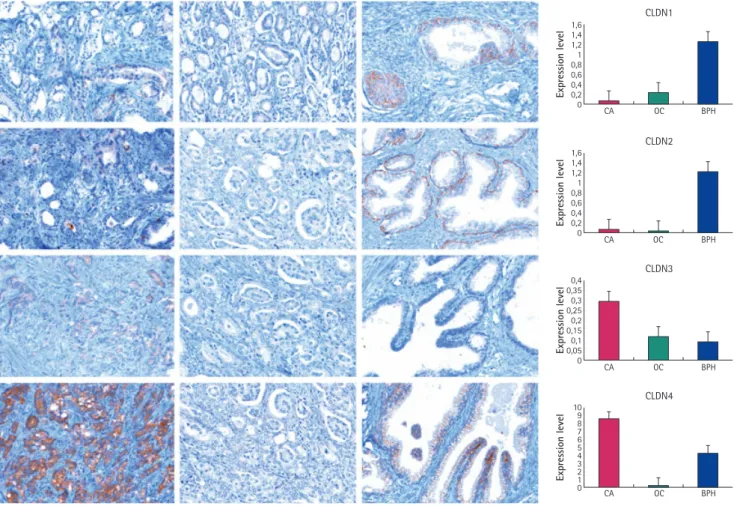 FIG. 1.  Immunohistochemical images of the expression of the evaluated claudin-1, -2, -3 and -4