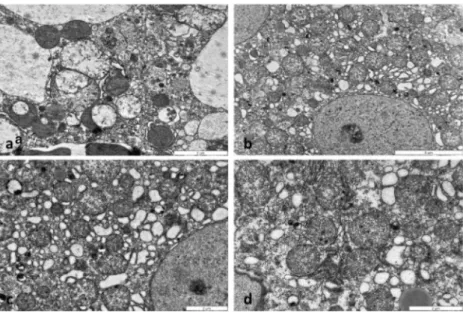 Fig. 2 Electron micrographs of mouse livers treated with APAP ( a ), BGP15 ( b ), untreated control ( c ) and APAP+BGP15 ( d ) for 6 h.