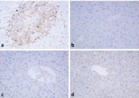 Fig. 4 Strong granular immunohistochemical reaction with antibodies to TOMM20 ( a ), beclin1 ( b ), LC3 ( c ) and p62 ( d ) after APAP-treatment