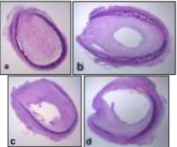 Figure 6.  Rat  trachea histological  section  on  day  21  of  vehiculum (a),  bosentan  (b),  ramipril (c) and ramipril + bosentan, (d)-treated allografts (HE staining, magnification 