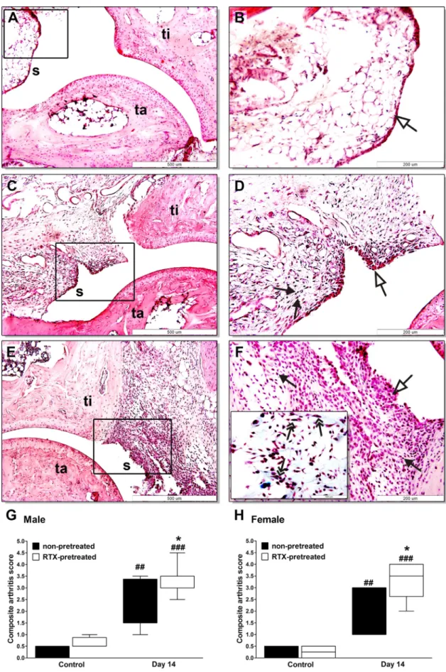 Fig. 6. Histopathological changes of the ankle joints. Panels (A and B) show representative histopathological pictures of an intact tibiotarsal joint (ti: tibia, ta: tarsus, s: