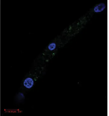 14. ábra Egészséges lencseepithelsejtek immunhisztokémiai felvétele –  cavin-1- (1 : 200 hígítás) jel zölddel látható, a sejtmagok DAPI-  festékkel kék jelet adnak