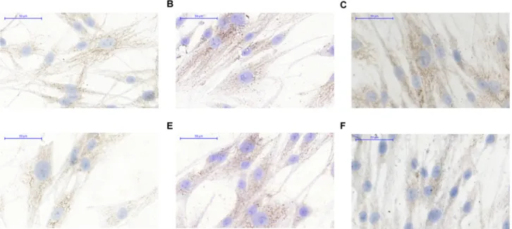 Fig 7. DNMT3a expression in HDF alpha fibroblasts after the treatment by sterile PBS(A), by DNA from normal colon epithelium(B), by DNA from tumorous colon epithelium(C), NF κ B expression after the treatment by sterile PBS(D), by DNA from normal colon epi