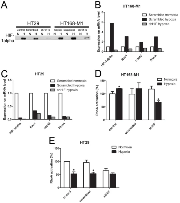 Figure 4: Effect of HIF-1α gene silencing on protein and mRNA expression and RhoA activation