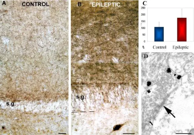 Figure  5.  Distribution  of  CB1-R  associated  with  symmetric  synapses  at  light  and  electron microscopic level in human dentate gyrus  