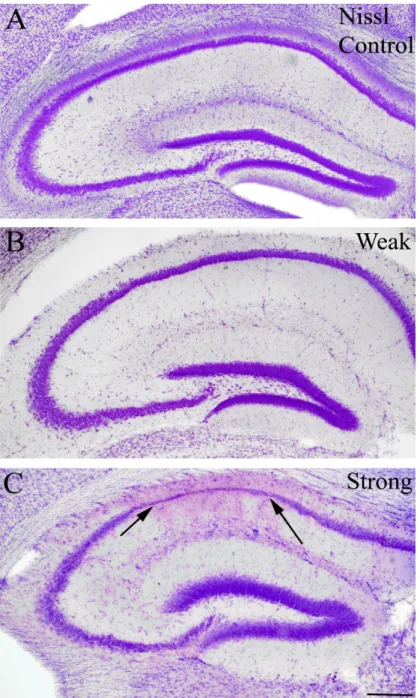 Figure 10:  Anatomical changes in pilocarpine induced epilepsy with Nissl staining  Light micrographs of control (A) and epileptic (B, C) animals with Nissl staining