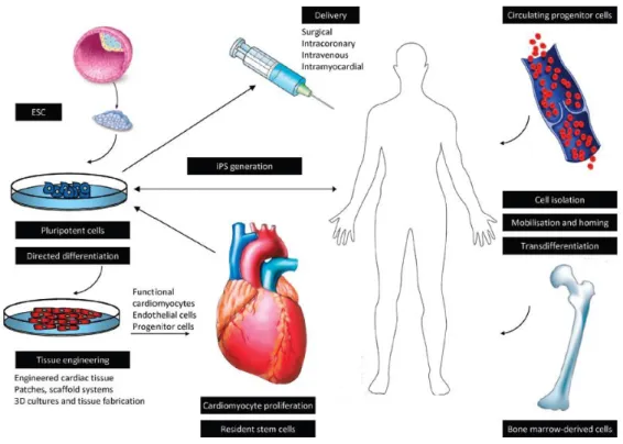Figure  1.  Experimental  approaches  to  cell  therapy  in  heart  failure  Figure  shows  experimental  approaches,  cell  types  and  cell  delivery  routes  for  regenerative  purposes  in  heart  failure  (Figure  is  from  Kosztin/Gara  et  al