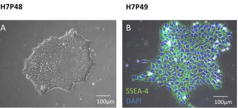Figure 13. Phenotype in vitro and immunocytochemical properties of pluripotent stem  cell  colonies  (A)  Figure  shows  pluripotent  stem  cell  colonies  in  culture,  captured  by  inverted light microscope  (H7 passage 48) (B) Pluripotency marker SSEA-