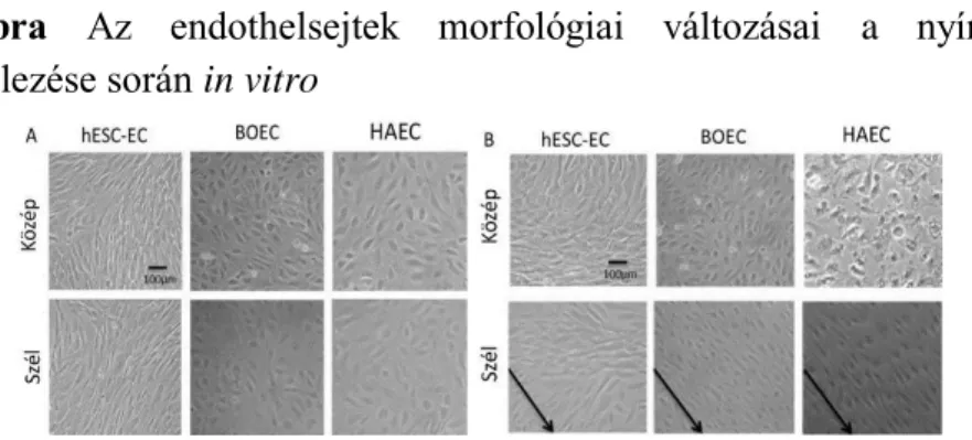 4. ábra hESC-EC és hiPSC-EC endotheliális génexpressziós mintázata 