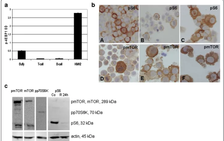 Figure 2 mTOR signaling activity is increased in Hodgkin-lymphoma cell lines. a. The amount of phosphorylated 4EBP1 protein is elevated in KMH2 Hodgkin-lymphoma cell line compared to normal B-cells, T-cells and buffy coat samples