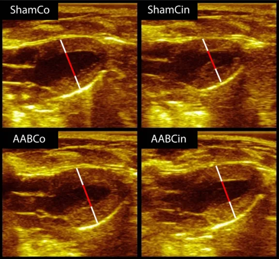 Figure 1.  Representative echocardiographic images from the 6 th  week in diastole. White bars represent  walls, and red bars show cavities