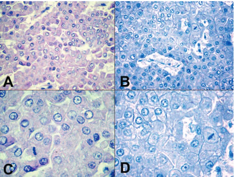 Fig. 3. Canine hepatocellular carcinomas were negative for claudin-7 A. HE. B. IHC. C