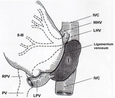 Figure 4: “The caudate lobe  (shaded)-segments  II and III are rotated to  the patient’s  right